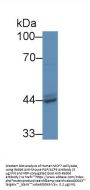 Prostatic Acid Phosphatase (ACP3) Antibody