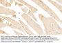 Prostatic Acid Phosphatase (ACP3) Antibody