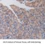 Activin A Receptor Type 1B (ACVR1B) Antibody
