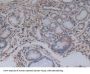 Charcot Leyden Crystal Protein (CLC) Antibody