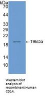 Cluster Of Differentiation 14 (CD14) Antibody