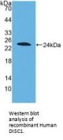 Disrupted In Schizophrenia 1 (DISC1) Antibody