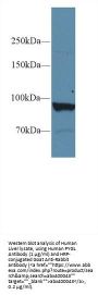 Glycogen Phosphorylase, Liver (PYGL) Antibody