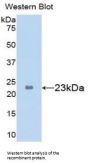 Glycogen Phosphorylase, Liver (PYGL) Antibody