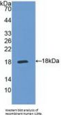 Interleukin 5 Receptor alpha (IL5RA) Antibody