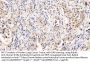 Interleukin 5 Receptor alpha (IL5RA) Antibody