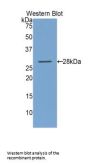 Lysyl Oxidase Like Protein 1 (LOXL1) Antibody