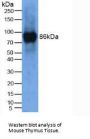 Lysyl Oxidase Like Protein 2 (LOXL2) Antibody