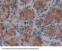Lysyl Oxidase Like Protein 4 (LOXL4) Antibody