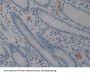 Neural Cell Adhesion Molecule (NCAM) Antibody