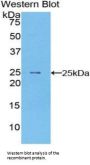 Peripheral Myelin Protein 22 (PMP22) Antibody