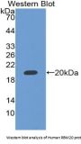 RBM20 Antibody