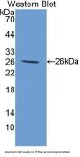 Transglutaminase 3, Epidermal (TGM3) Antibody