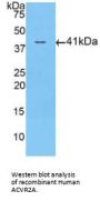 Activin A Receptor Type 2A (ACVR2A) Antibody