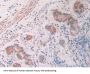 Activin A Receptor Type 2A (ACVR2A) Antibody