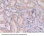 Activin A Receptor Type 2A (ACVR2A) Antibody