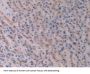 Activin A Receptor Type 2A (ACVR2A) Antibody