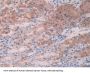 Activin A Receptor Type 2A (ACVR2A) Antibody