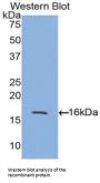 Activin A Receptor Type 2A (ACVR2A) Antibody