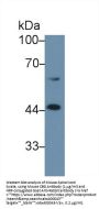 Corticosteroid Binding Globulin (SERPINA6) Antibody