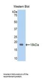 Corticosteroid Binding Globulin (SERPINA6) Antibody