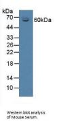Corticosteroid Binding Globulin (SERPINA6) Antibody