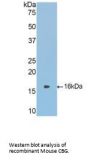 Corticosteroid Binding Globulin (SERPINA6) Antibody