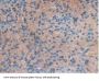 Corticosteroid Binding Globulin (SERPINA6) Antibody