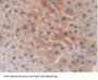 Corticosteroid Binding Globulin (SERPINA6) Antibody