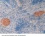 Corticosteroid Binding Globulin (SERPINA6) Antibody