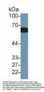 Corticosteroid Binding Globulin (SERPINA6) Antibody