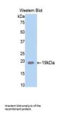 Corticosteroid Binding Globulin (SERPINA6) Antibody