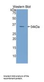 Endothelin Converting Enzyme 1 (ECE1) Antibody