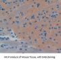 Endothelin Converting Enzyme 1 (ECE1) Antibody