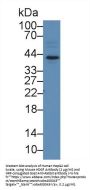 Hepatoma Derived Growth Factor (HDGF) Antibody