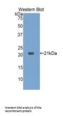 Hepatoma Derived Growth Factor (HDGF) Antibody