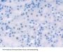 Hepatoma Derived Growth Factor (HDGF) Antibody