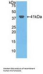 Histone Cluster 2, H2aa3 (HIST2H2AA3) Antibody