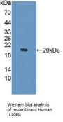 Interleukin 10 Receptor Beta (IL10Rb) Antibody
