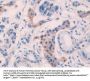Interleukin 10 Receptor Beta (IL10Rb) Antibody