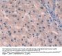Interleukin 10 Receptor Beta (IL10Rb) Antibody