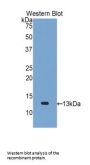 C-C Motif Chemokine 2 / MCP1 (CCL2) Antibody