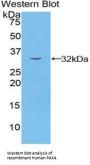 p21 Protein Activated Kinase 4 (PAK4) Antibody