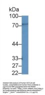 p21 Protein Activated Kinase 4 (PAK4) Antibody