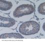 Phospholipase A2, Group IIA (PLA2G2A) Antibody