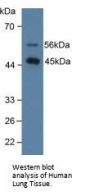 Pulmonary Surfactant-Associated Protein D (SFTPD) Antibody
