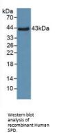 Pulmonary Surfactant-Associated Protein D (SFTPD) Antibody