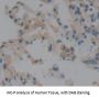 Pulmonary Surfactant-Associated Protein D (SFTPD) Antibody