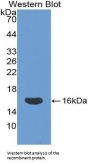 Cluster of Differentiation 160 (CD160) Antibody