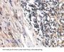 Connective Tissue Growth Factor (CCN2) Antibody